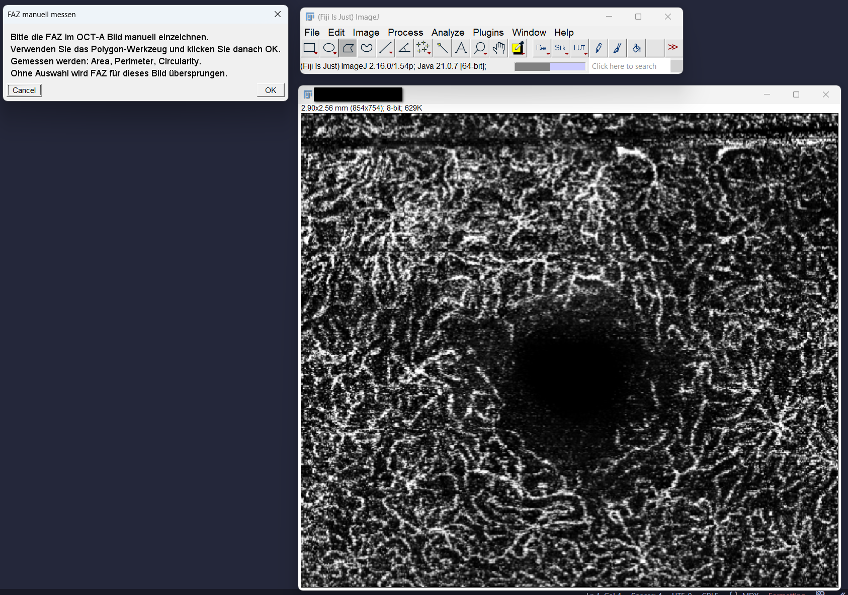imagej_step